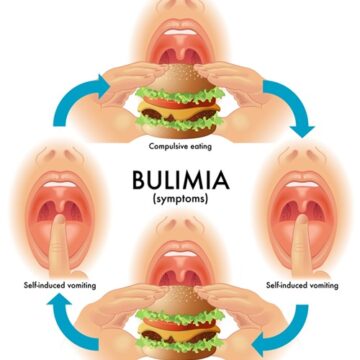 ما هو مرض البوليميا وما هي اعراضه